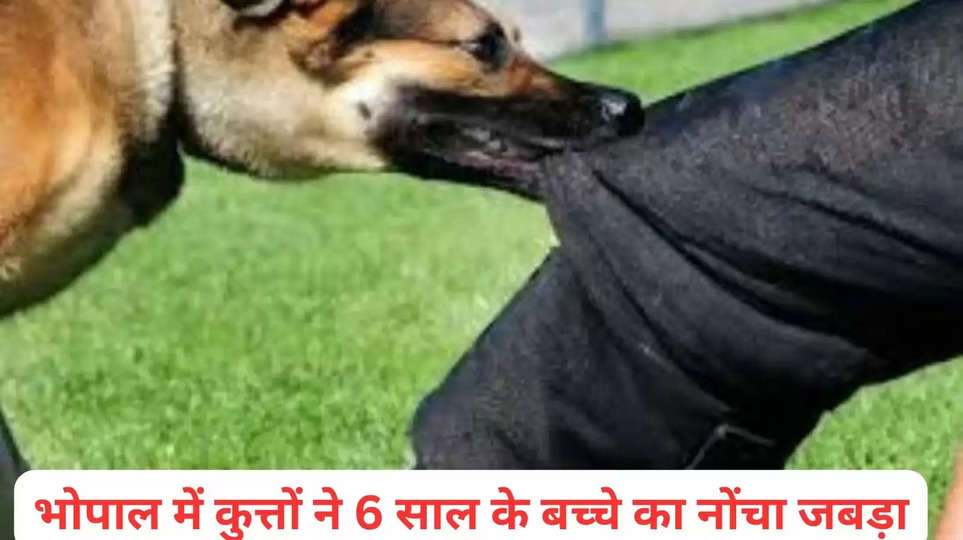 bhopal, bhopal Dog Attack, Dog Attack in bhopal, child dog attack, Dog bite News, Bhopal Dog Bite, भोपाल में कुत्ते का हमला"